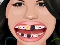 Selena Gomez Perfect Teeth 