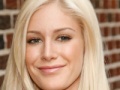 Image Disorder Heidi Montag