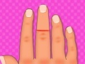 Finger surgery