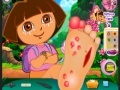 Dora Foot Injuries