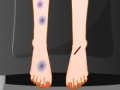 Sara Feet Accident