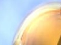 Gem Globoid: Resistance Battle